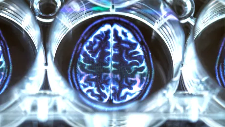 Abbildung einer Aufnahme des menschlichen Gehirns
